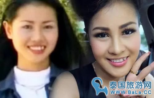 泰国8个女歌星整容前后对比照 个个都是蛇精脸