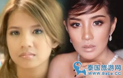 泰国8个女歌星整容前后对比照 个个都是蛇精脸