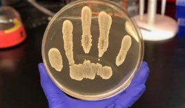 世界上十大最强细菌：表皮葡萄球菌排第一，远古细菌居第二