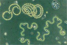 世界上最小的活生物体：古菌微生物直径约为200纳米
